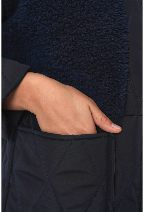 5182 Peluş Detaylı Oversize Şişme Mont