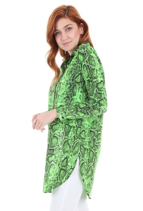 5704 Neon Tunik