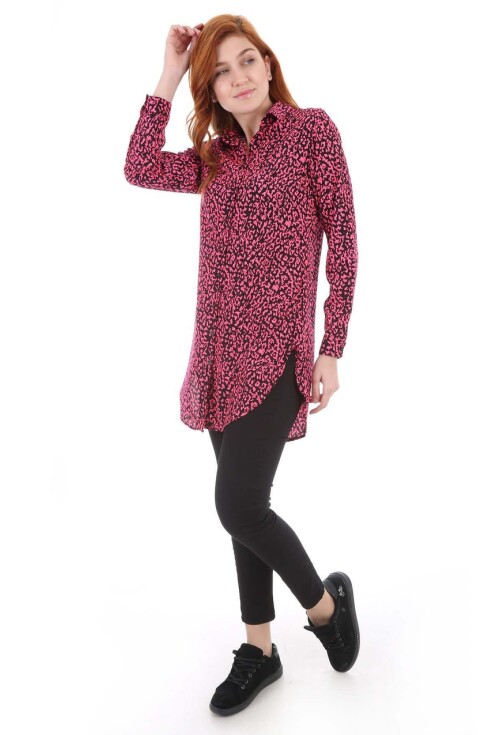 5704 Neon Tunik