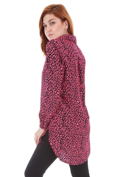 5704 Neon Tunik