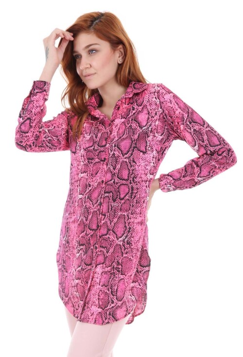 5704 Neon Tunik