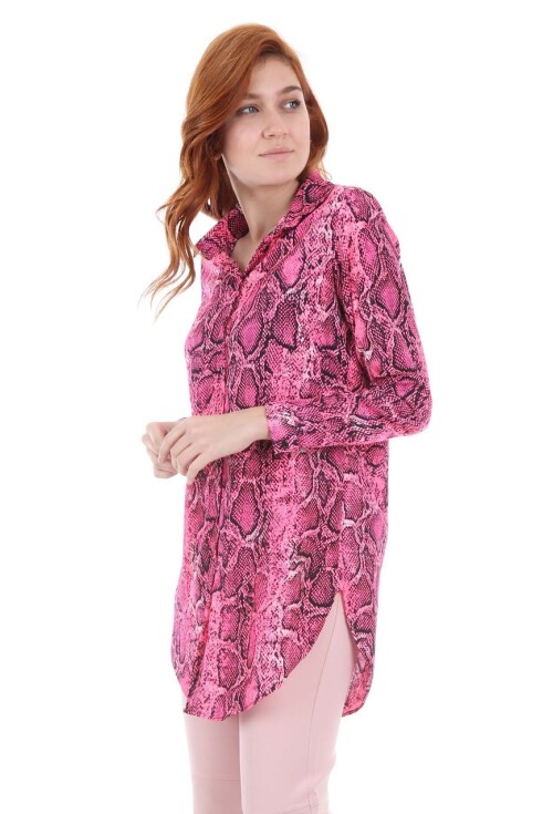 5704 Neon Tunik
